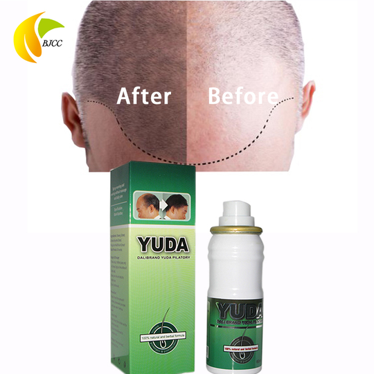 Best Magic YUDA Regrow Hair Spray for Anti Hair Loss