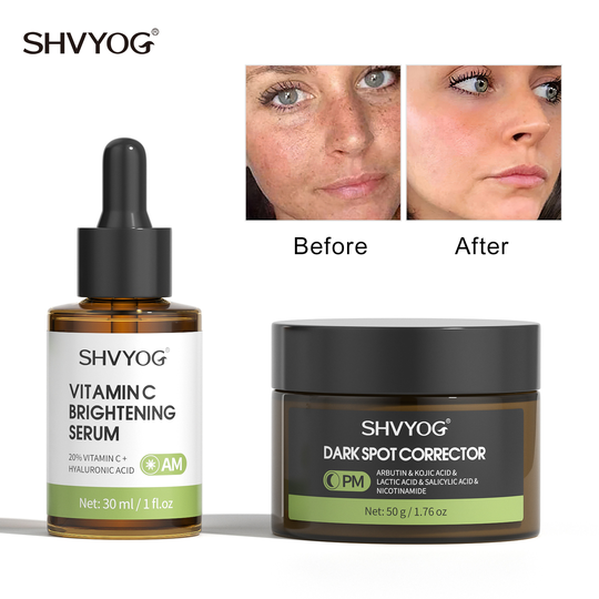 OEM ODM Natural Anti Aging Brightening Collagen Anti Aging Vitamin C Dark Spot Corrector Spot Remover Serum For Face