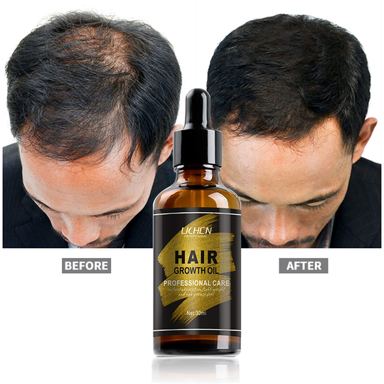 alibaba top 10 wild growth hair oil extreme 7 day beard hair growth oil vendors best oil for hair growth fast effect