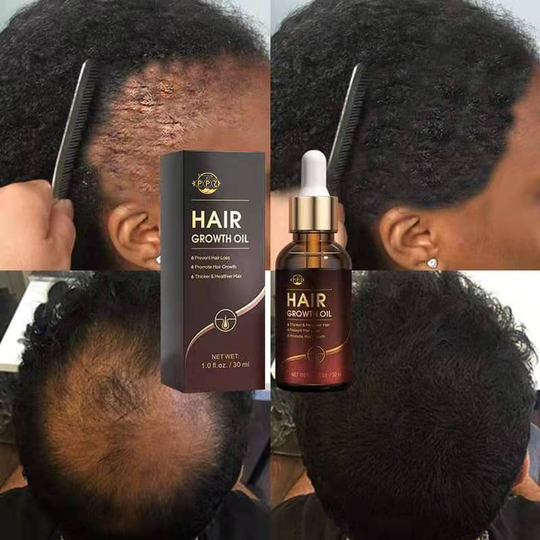 China's own brand Wild Olive Oil regenerated hair oil thickening care enhancement fluid hair growth serum private label