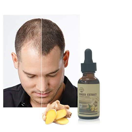 Organic Private Label Sulfate Free Wholesale Hair Care Product Series Anti Hair Loss Serum Fall Ginger Hair Growth Oil