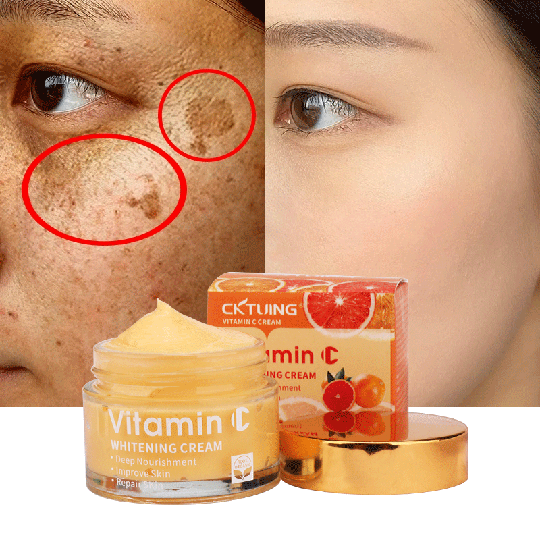 private label organic skin care dark spot remover anti aging acne wrinkle moisturizer vitamin c face whitening cream